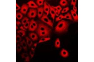 Immunofluorescent analysis of Calpain 5 staining in A549 cells. (Calpain 5 抗体)