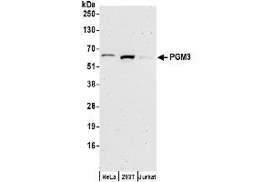 Western Blotting (WB) image for anti-Phosphoglucomutase 3 (PGM3) (AA 492-542) antibody (ABIN7450562)