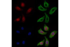 ABIN7093314 and ABIN7097333 staining Hela cells by IF/ICC. (p53 抗体  (C-Term))