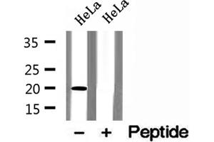 Western blot analysis of extracts of HeLa cells, using ARL3 antibody. (ARL3 抗体  (C-Term))