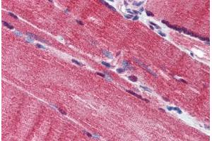Human Skeletal Muscle (formalin-fixed, paraffin-embedded) stained with IQWD1 antibody ABIN293866 at 10 ug/ml followed by biotinylated goat anti-rabbit IgG secondary antibody ABIN481713, alkaline phosphatase-streptavidin and chromogen. (DCAF6 抗体  (AA 800-850))