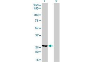 Western Blotting (WB) image for anti-Methylenetetrahydrofolate Dehydrogenase (NADP+ Dependent) 2, Methenyltetrahydrofolate Cyclohydrolase (MTHFD2) (AA 16-344) antibody (ABIN564706)