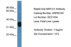 WB Suggested Anti-AKR1C1  Antibody Titration: 0. (AKR1C1 抗体  (N-Term))