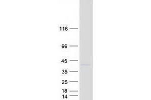 Vasohibin 2 (VASH2) (Transcript Variant 1) protein (Myc-DYKDDDDK Tag)