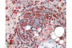 Immunohistochemistry (IHC) image for anti-Actin Related Protein 2/3 Complex, Subunit 2, 34kDa (ARPC2) (C-Term) antibody (ABIN184748)
