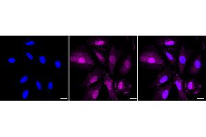 Immunocytochemical staining of H9C2 cells with HSPB6 antibody (ABIN7798877), 1:1,000).