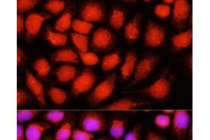 Immunofluorescence analysis of Hela cells using DNAJB14 Polyclonal Antibody at dilution of 1:100 (40x lens). (DNAJB14 抗体)