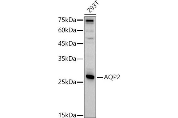 AQP2 抗体  (AA 147-271)