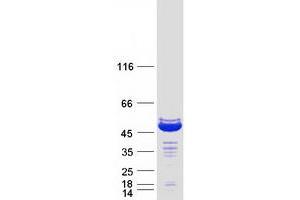 Validation with Western Blot