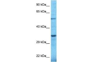 Host:  Rabbit  Target Name:  TULP2  Sample Type:  OVCAR-3 Whole Cell lysates  Antibody Dilution:  1. (TULP2 抗体  (C-Term))