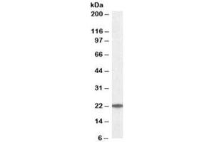 Western blot testing of K562 lysate with UBE2T antibody at 0. (Ube2t 抗体)