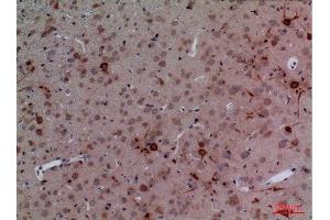 Immunohistochemistry (IHC) image for anti-Cullin 4B (CUL4B) (Internal Region) antibody (ABIN3187726)