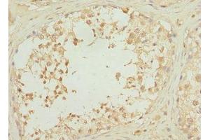 Immunohistochemistry of paraffin-embedded human testis tissue using ABIN7168204 at dilution of 1:100 (RPS6KL1 抗体  (AA 1-130))