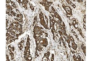 IHC analysis of NSF using anti-NSF antibody (ABIN7601630). (NSF 抗体  (AA 4-636))