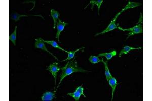 Immunofluorescent analysis of MCF-7 cells using ABIN7152131 at dilution of 1:100 and Alexa Fluor 488-congugated AffiniPure Goat Anti-Rabbit IgG(H+L) (EIF2S1 抗体  (AA 276-315))