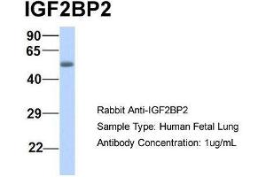 Host:  Rabbit  Target Name:  IGF2BP2  Sample Type:  Human Fetal Lung  Antibody Dilution:  1. (IGF2BP2 抗体  (Middle Region))