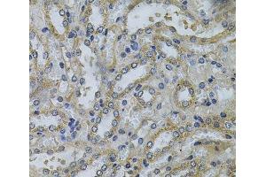 Immunohistochemistry of paraffin-embedded Mouse kidney using SERPINE2 Polyclonal Antibody at dilution of 1:100 (40x lens). (SERPINE2 抗体)