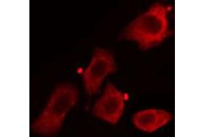 ABIN6268919 staining HuvEc cells by IF/ICC. (Caveolin-1 抗体  (C-Term))