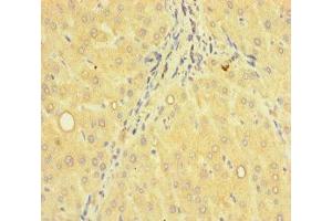 Immunohistochemistry of paraffin-embedded human liver tissue using ABIN7143108 at dilution of 1:100 (ACTR5 抗体  (AA 183-285))