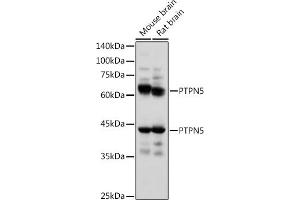 Western blot analysis of extracts of various cell lines, using PTPN5 antibody (ABIN7269705) at 1:1000 dilution. (PTPN5 抗体  (AA 360-490))