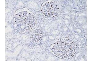 Immunohistochemical staining (Formalin-fixed paraffin-embedded sections) of human fetal kidney with WT1 monoclonal antibody, clone WT1/857 . (WT1 抗体)