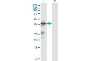Western Blot analysis of C13orf31 expression in transfected 293T cell line by C13orf31 monoclonal antibody (M04), clone 2A1. (LACC1 抗体  (AA 1-430))