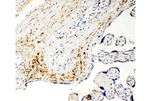 Immunohistochemistry (IHC) image for anti-Solute Carrier Family 16 (Monocarboxylic Acid Transporters), Member 4 (SLC16A4) (N-Term) antibody (ABIN3032674)