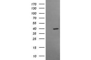 Image no. 1 for anti-Musashi Homolog 1 (Drosophila) (MSI1) antibody (ABIN1499574) (MSI1 抗体)