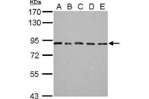WB Image MAD1 antibody detects MAD1L1 protein by Western blot analysis.