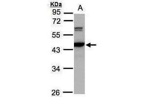 WB Image Sample(30 ug whole cell lysate) A:293T 10% SDS PAGE antibody diluted at 1:2000 (CAMK4 抗体)