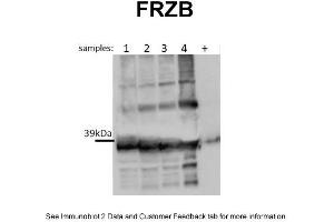 WB Suggested Anti-FRZB Antibody Titration: 0. (FRZB 抗体  (N-Term))