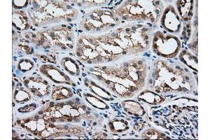 Image no. 7 for anti-Acetyl-CoA Acetyltransferase 2 (ACAT2) antibody (ABIN1496404)
