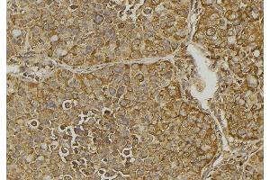 ABIN6279828 at 1/100 staining Human pancreas tissue by IHC-P. (CXCL11 抗体  (Internal Region))
