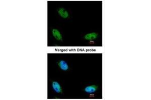 ICC/IF Image Immunofluorescence analysis of paraformaldehyde-fixed HeLa, using NSUN6, antibody at 1:200 dilution. (NSUN6 抗体  (Center))