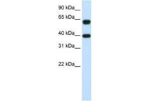 NXF3 antibody used at 1. (NXF3 抗体  (C-Term))