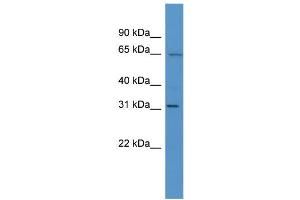 WB Suggested Anti-Hoxc12 Antibody Titration:  0. (HOXC12 抗体  (N-Term))