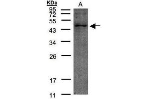 WB Image Sample(30 μg of whole cell lysate) A:HeLa S3, 12% SDS PAGE antibody diluted at 1:200 (TMLHE 抗体)