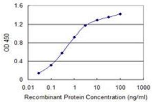 Detection limit for recombinant GST tagged MCM8 is 0. (MCM8 抗体  (AA 646-735))
