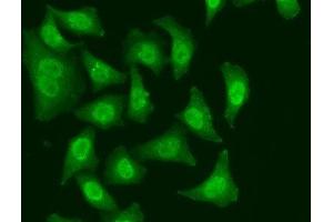 Immunofluorescence analysis of A549 cells using CDC5L Polyclonal Antibody (CDC5L 抗体)