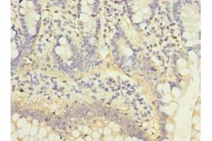 Immunohistochemistry of paraffin-embedded human small intestine tissue using ABIN7175029 at dilution of 1:100 (C5ORF22 抗体  (AA 101-420))