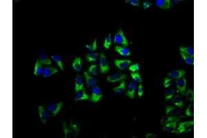 Immunofluorescence staining of Hela cells with ABIN7145792 at 1:66, counter-stained with DAPI. (BROX 抗体  (AA 288-409))