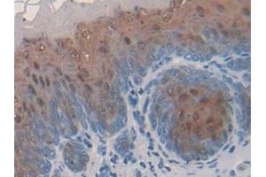 Detection of FABP9 in Mouse Esophagus Tissue using Polyclonal Antibody to Fatty Acid Binding Protein 9, Testis (FABP9) (FABP9 抗体  (AA 1-132))