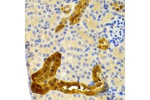 Immunohistochemistry of paraffin-embedded mouse kidney using PVALB antibody at dilution of 1:200 (400x lens). (PVALB 抗体)