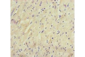 Immunohistochemistry of paraffin-embedded human heart tissue using ABIN7165198 at dilution of 1:100 (CRBN 抗体  (AA 1-280))
