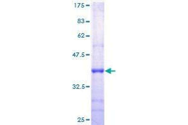 ROPN1 Protein (AA 1-120) (GST tag)