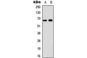 Western blot analysis of DDX5 expression in A431 (A), SHSY5Y (B) whole cell lysates. (DDX5 抗体  (C-Term))