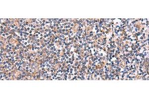 Immunohistochemistry of paraffin-embedded Human tonsil tissue using INPP5B Polyclonal Antibody at dilution of 1:40(x200)