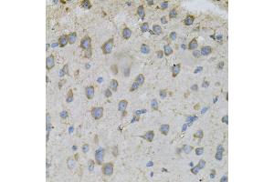 Immunohistochemistry of paraffin-embedded mouse brain using DBI Antibody. (Diazepam Binding Inhibitor 抗体)