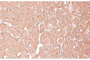 Immunohistochemistry of paraffin-embedded Rat heart using FRMD6 Polyclonal Antibody at dilution of 1:100 (40x lens). (FRMD6 抗体)