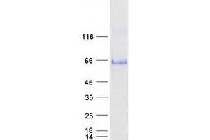Western Blotting (WB) image for MHC Class I Polypeptide-Related Sequence A (MICA) protein (Myc-DYKDDDDK Tag) (ABIN2725967)